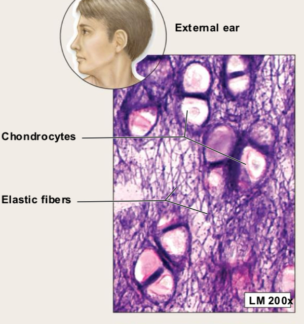<p>Elastic Cartilage (Structure)</p>