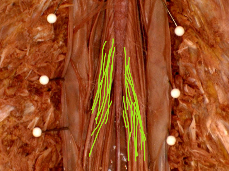 <p>what is the highlighted structure </p>
