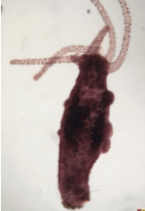 <p>with what sexorgan</p>