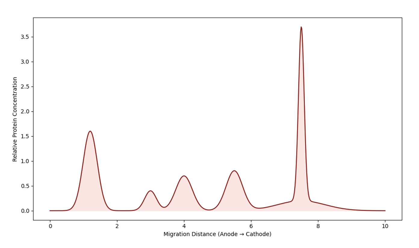 <p>72 year old presents with back pain, fatigue and anemia. </p><p><strong>Labs: </strong></p><p>total protein : 10.2 g/dL</p><p> ↓ albumin </p><p>SPEP shows sharp spike in y region </p><p>immunofixation identifies IgG k </p>