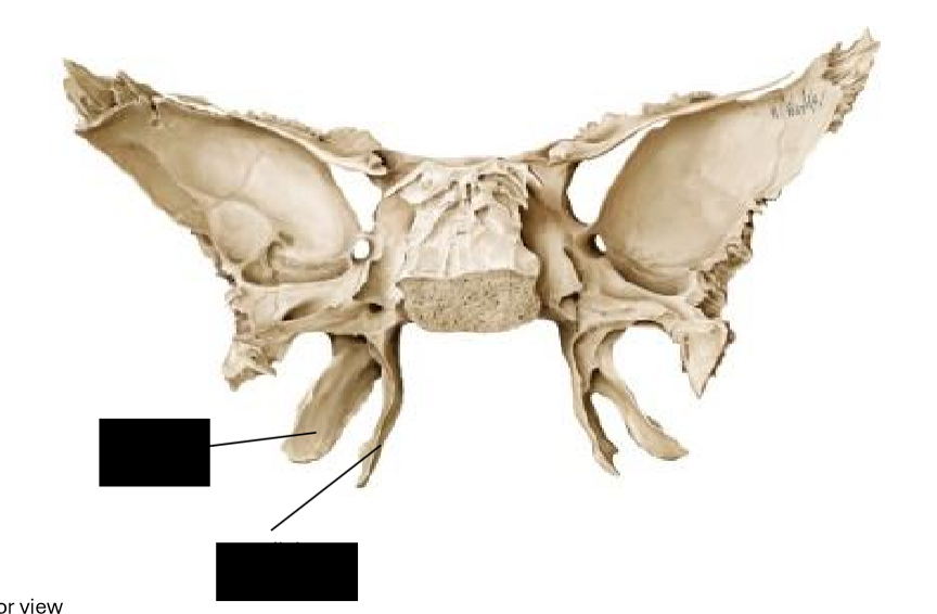 <p>Label diagram </p>
