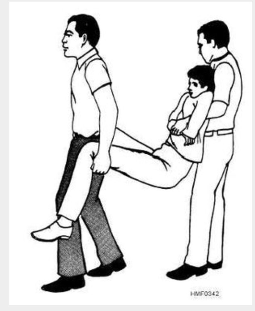 <p>lifting technique that is used for patients who are found laying supine or in a sitting position with no suspected extremity or spinal injury</p>