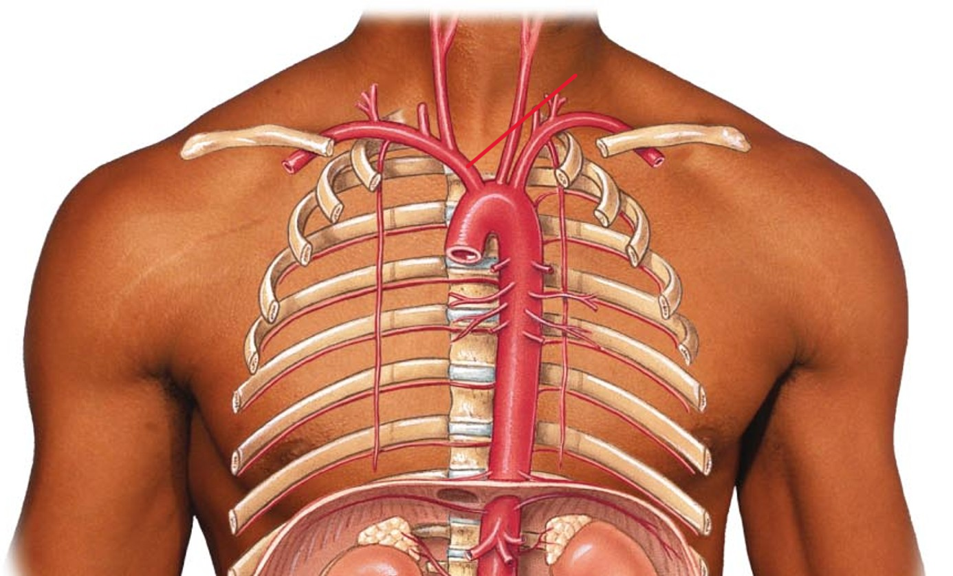 <p>Name the artery</p>