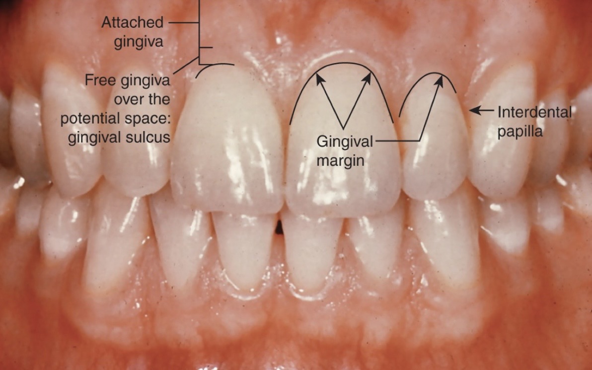 <p>A collar of thin gingiva that surrounds each tooth.</p>
