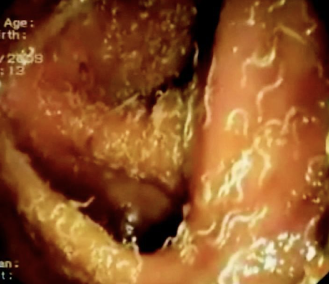 <p>what helminth is this?</p>