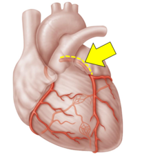 <p>Name the red vessel.</p>