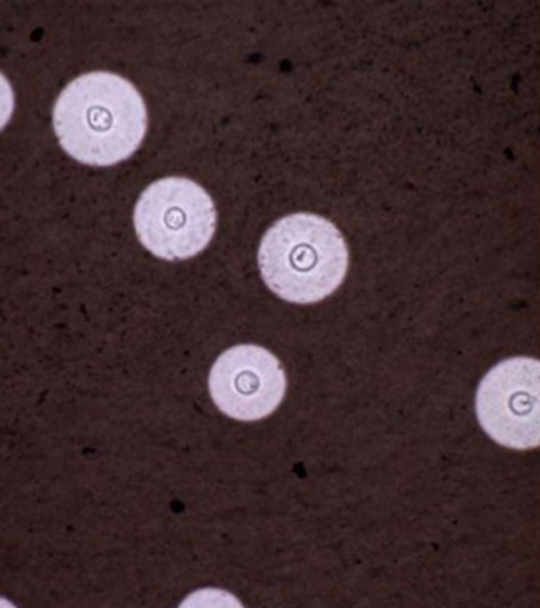 <p>Dark background</p><p>Shows capsule of cryptococcus neoformans</p>