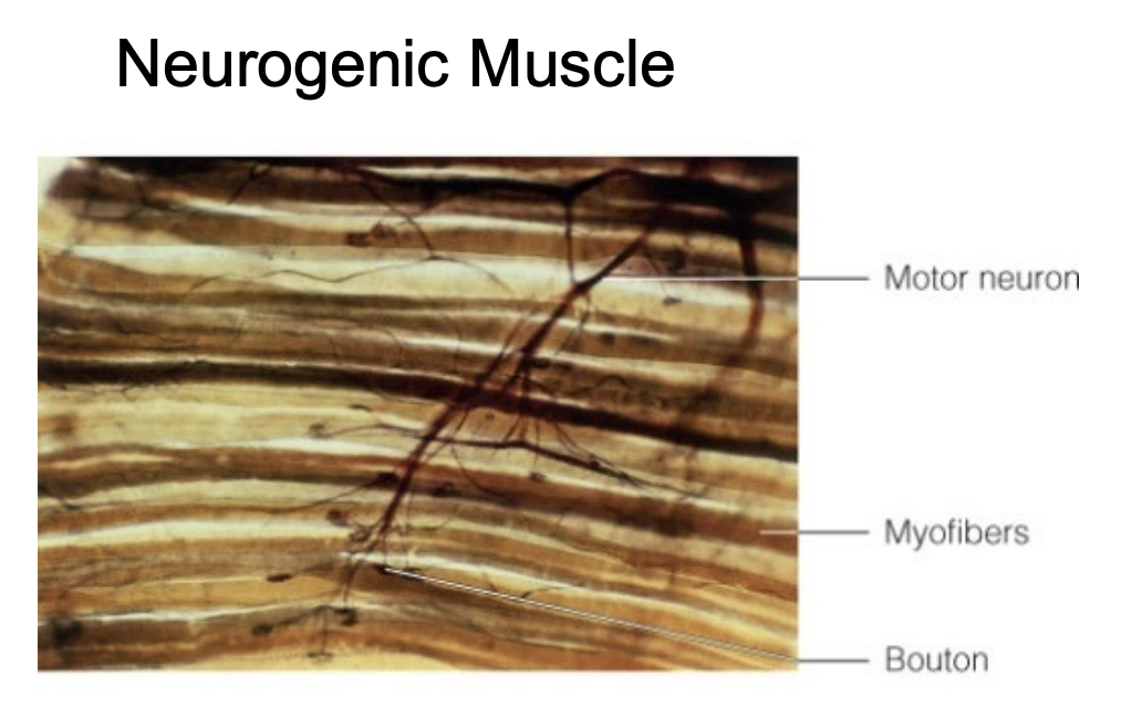 <ul><li><p>Muscle is triggered by nerve</p><ul><li><p>Nerve sends message to NMJ → depolarization → contraction</p><ul><li><p>Skeletal</p></li></ul></li></ul></li></ul><p></p>