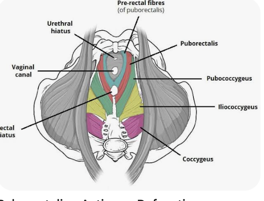 <p>O: Anteriorly, from the pubic symphysis</p><p>I: Posteriorly, encircling the anorectal junction (integrating in part with the external butthole)</p><p>A: Inhibits deification </p>