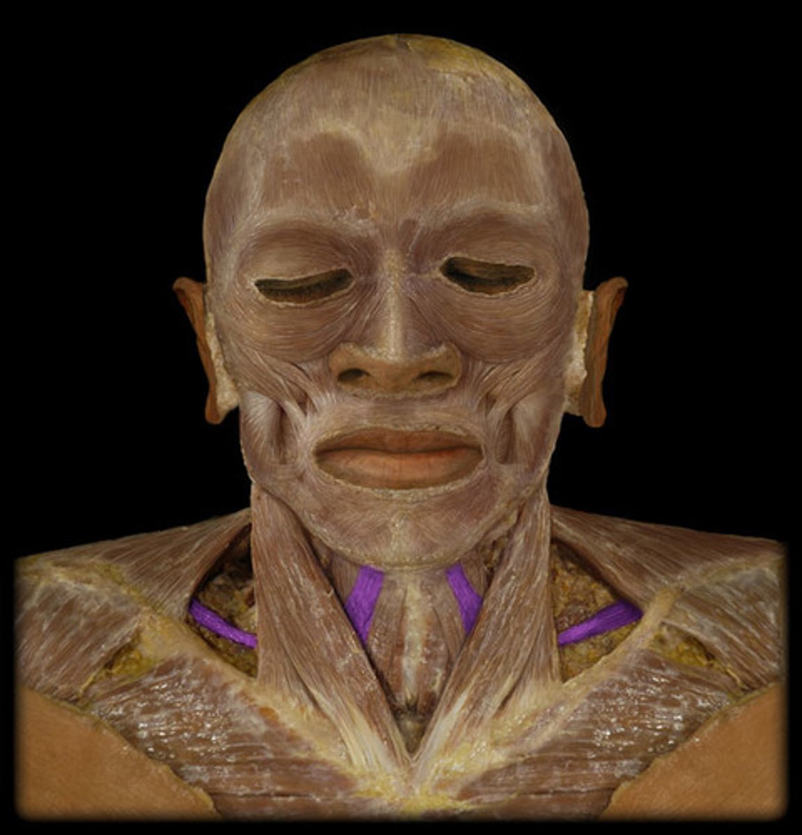 <p>Region:</p><p>Neck</p><p>Action:</p><p>Depresses hyoid</p><p>Innervation:</p><p>Cervical plexus </p>