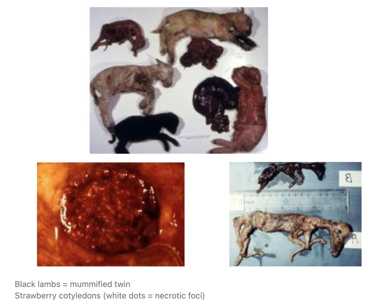 <p><u>Agent:</u> Protozoan parasite <em>Toxoplasma gondii</em></p><ul><li><p>IH = Sheep (ALL mammals, birds and reptiles)</p><ul><li><p>Mouse + cat = Maintenance cycle</p></li><li><p>ZOONOTIC!!!</p></li></ul></li><li><p>DH = Cat (tissue cysts can spillover from GI infection)</p></li></ul><p><u>Lifecycle:</u> </p><ol><li><p><strong>Cat</strong> (DH) infected via:</p><ol><li><p>Bradyzoites within tissue of IH (sheep/mouse)</p></li><li><p>Sporozoites from sporulated oocysts in environment</p></li></ol></li><li><p><em>Toxoplasma</em> undergoes schizogony and gametogony → Unsporulated oocysts which are shed in faeces</p></li><li><p><strong>Environment</strong> = Unsporulated oocysts undergo sporogony to produce an oocyst with 2 sporocysts each with 4 sporozoites (2 - 3d)</p></li><li><p>Sporulated oocyst within cat faeces ingested by IH sheep which liberates sporozoites</p></li><li><p>Sporozoites invade GI cells and transform into tachyzoites which can disseminate to brain, heart, lung, eye, muscle, placenta via monocytes</p><ul><li><p>Clinical signs reflect organs infected by tachyzoites</p></li></ul></li><li><p>Rate of division slows due to host immunity (2 - 3w) and switches to bradyzoite formation (100s of bradyzoites within a tissue cyst of ANY tissue)</p></li><li><p>Tissue cyst ingested by IH/DH which releases tachyzoites</p></li></ol><p><u>IP:</u> Long (up to 40d from infection to abortion)</p><p><u>Outcomes:</u> Tachyzoites cross placenta to infect foetus</p><ol><li><p><strong>Non-pregnant</strong> = Lifelong immunity</p><ul><li><p>Once infected, IH is immune to reinfection as tissue cysts with bradyzoites can periodically breakdown ⇔ tachyzoite which refreshes the parasite population and reinforces immune response </p></li></ul></li><li><p><strong>Early pregnancy</strong> = Embryonic death → Not pregnant at scanning</p></li><li><p><strong>Mid - late pregnancy</strong> = Abortion</p></li><li><p><strong>Late pregnancy</strong> = Weak lambs (immunity develops)</p><ul><li><p>Stillbirth uncommon</p></li></ul></li></ol><p><u>Ewes:</u> Healthy</p><p><u>PM:</u></p><ul><li><p><strong>Strawberry cotyledons</strong> = Necrotic placental lesions with dystrophic mineralisation</p></li><li><p>Variable appearance of foetus</p><ul><li><p>One twin may be affected, but other appears okay (both die) as one horn affected more than the other</p></li><li><p>± Mummified</p></li></ul></li></ul><p><u>Diagnosis:</u></p><ol><li><p>History</p><ul><li><p>Naive ewes (hoggets or 2-tooths) ONLY</p></li><li><p>Presence of ferrel cats (contamination of hay barns)</p></li><li><p>Low scanning% (EED)</p></li></ul></li><li><p>Clinical signs = Overt abortion with mummified lambs and strawberry cotyledons</p></li><li><p>Placenta/foetal brain for histopathology → ID tachyzoites</p></li><li><p>PCR of aborted materials</p></li><li><p>Foetal heart blood OR serum titres from ewe for Ab</p></li></ol><p><u>Control/Prevention:</u> Farmer PPE important as zoonotic disease</p><ol><li><p>Dispose of aborted tissue and lambs (consumed by cats to continue lifecycle)</p><ul><li><p>No need to isolate as no sheep-to-sheep transmission</p></li></ul></li><li><p>Vaccination with Toxovax = Live attenuated vaccine containing tachyzoites passaged through mice for many years</p><ul><li><p>Single dose ≥4w pre-mating to maiden ewes = Lifelong immunity</p></li><li><p>May NOT prevent abortion if high environmental challenge with oocysts (20% may still abort)</p></li></ul></li><li><p>Control ferrel cats</p></li></ol><p></p>