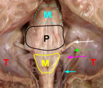 <p>Blue:</p><p>Pink:</p><p>Blue dotted:</p><p>White:</p><p>green:</p><p></p>