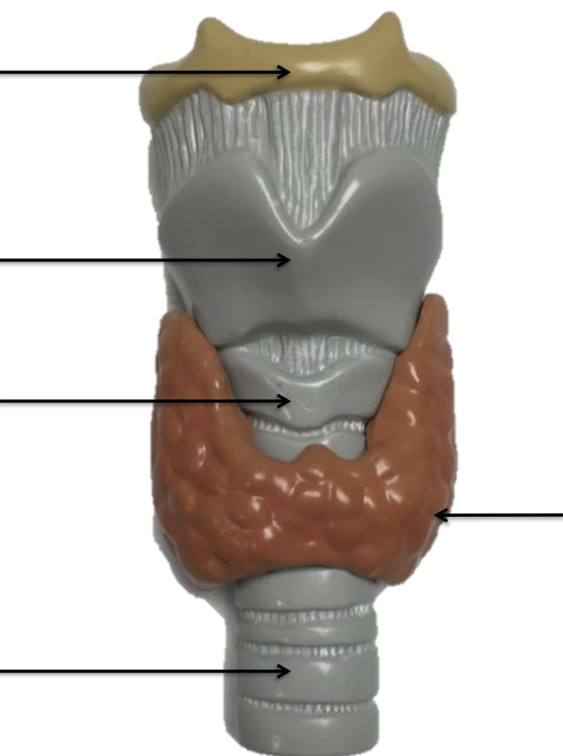 <p>top left arrow</p>