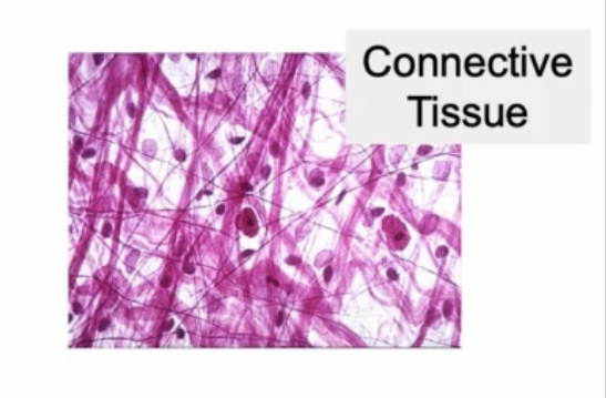 <p>Few scattered cells (identifiable by nuclei) making fibers (tissue) with a lot of background extracellular matrix (space)</p>