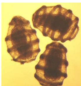 <p>larval stage of class Crinoidea, barrel-shaped and emerges from the auricuaria larval stage</p>