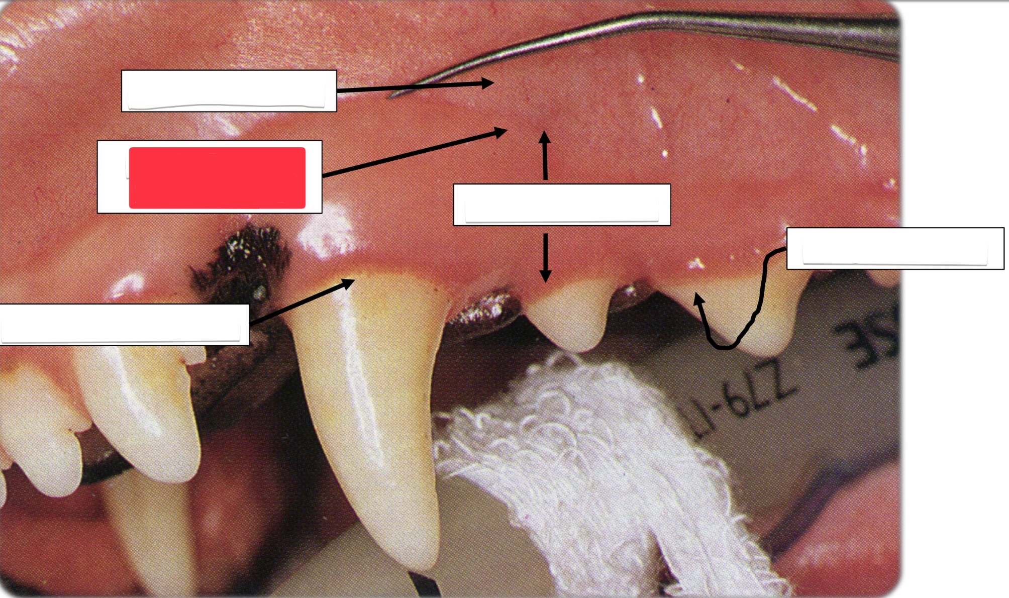 <p>Label this part of the gingiva.</p>