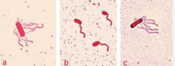 <p>what kind of stain is this ?</p>