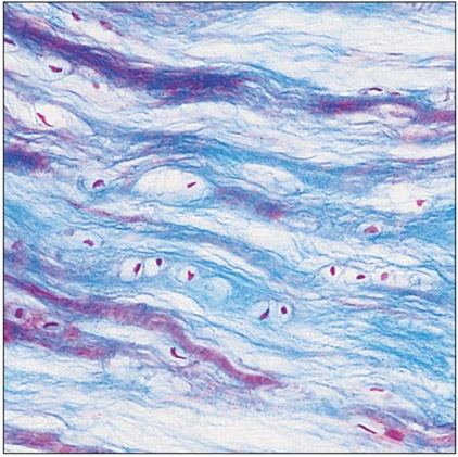 <p>fibrocartilage</p>