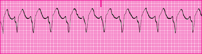 <p>Which rhythm is this?</p>