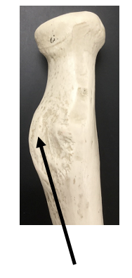 <p>What bone and bone feature is this?</p>