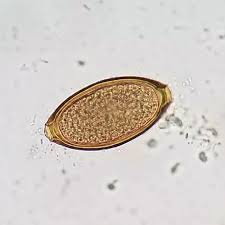 <p>A 5 year old dog has a high presence of this parasite. What does the presence of so many eggs mean?</p>