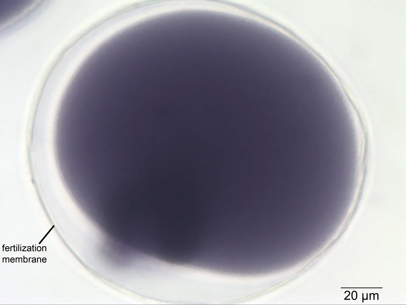 <p>fertilized egg</p>