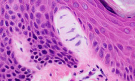 <p>what touch receptor is this?</p>