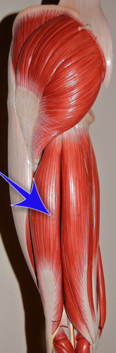 <p>What muscle is this?</p>