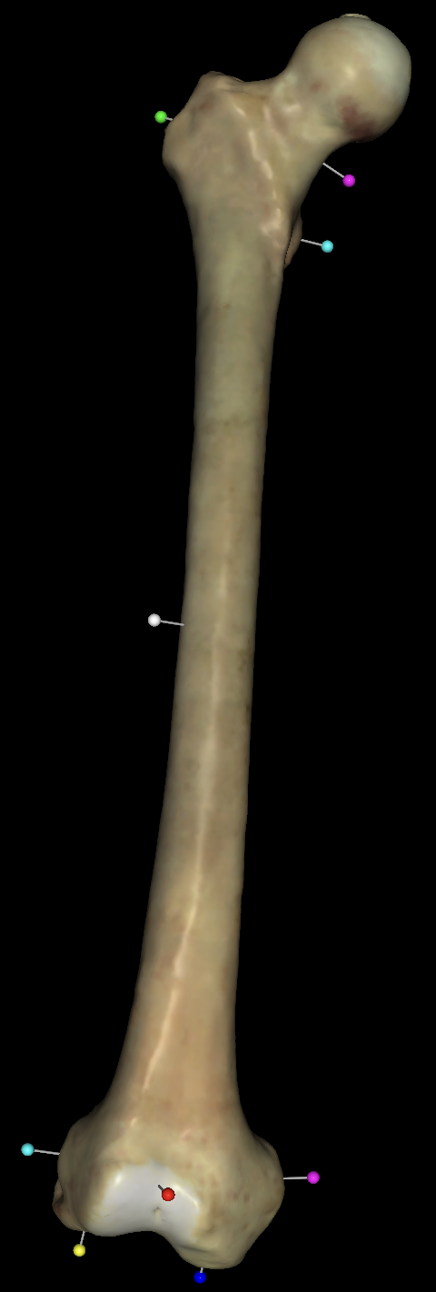 <p>what is the green tag on the right femurs?</p>