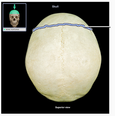<p>What structure is indicated</p>