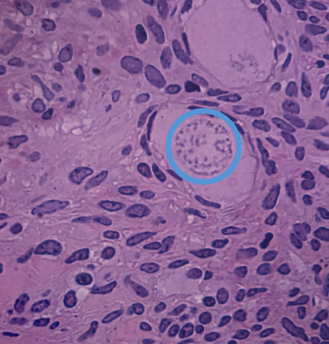 <p>surrounds ovarian follicles</p>