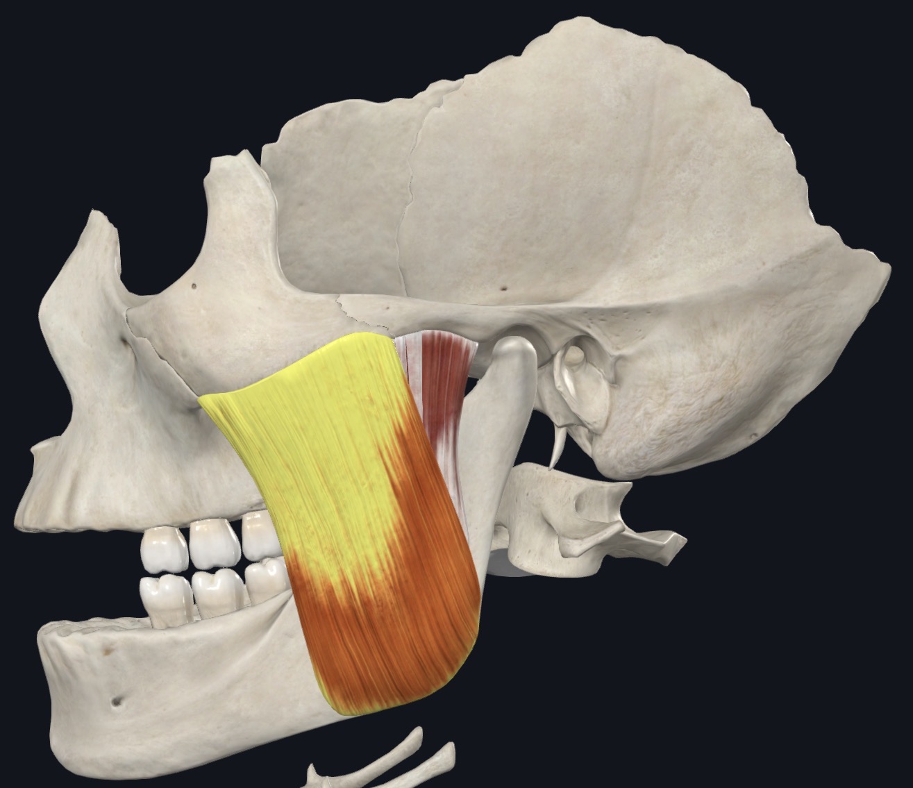 <p>Masseter Insertion</p>