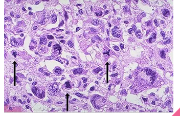 <p>Meaning "to form backward," these are cells that lose their specialized characteristics and revert to a more primitive, embryonic state.</p>