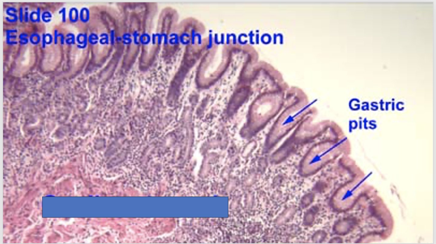 <p>Identify the structure</p>