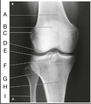 <p>Label the image: I</p>