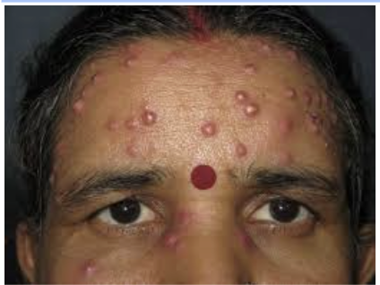 <p><span style="background-color: transparent;"><strong>Foreuncles&nbsp;</strong></span></p>