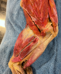 <p>Identify the muscle</p>
