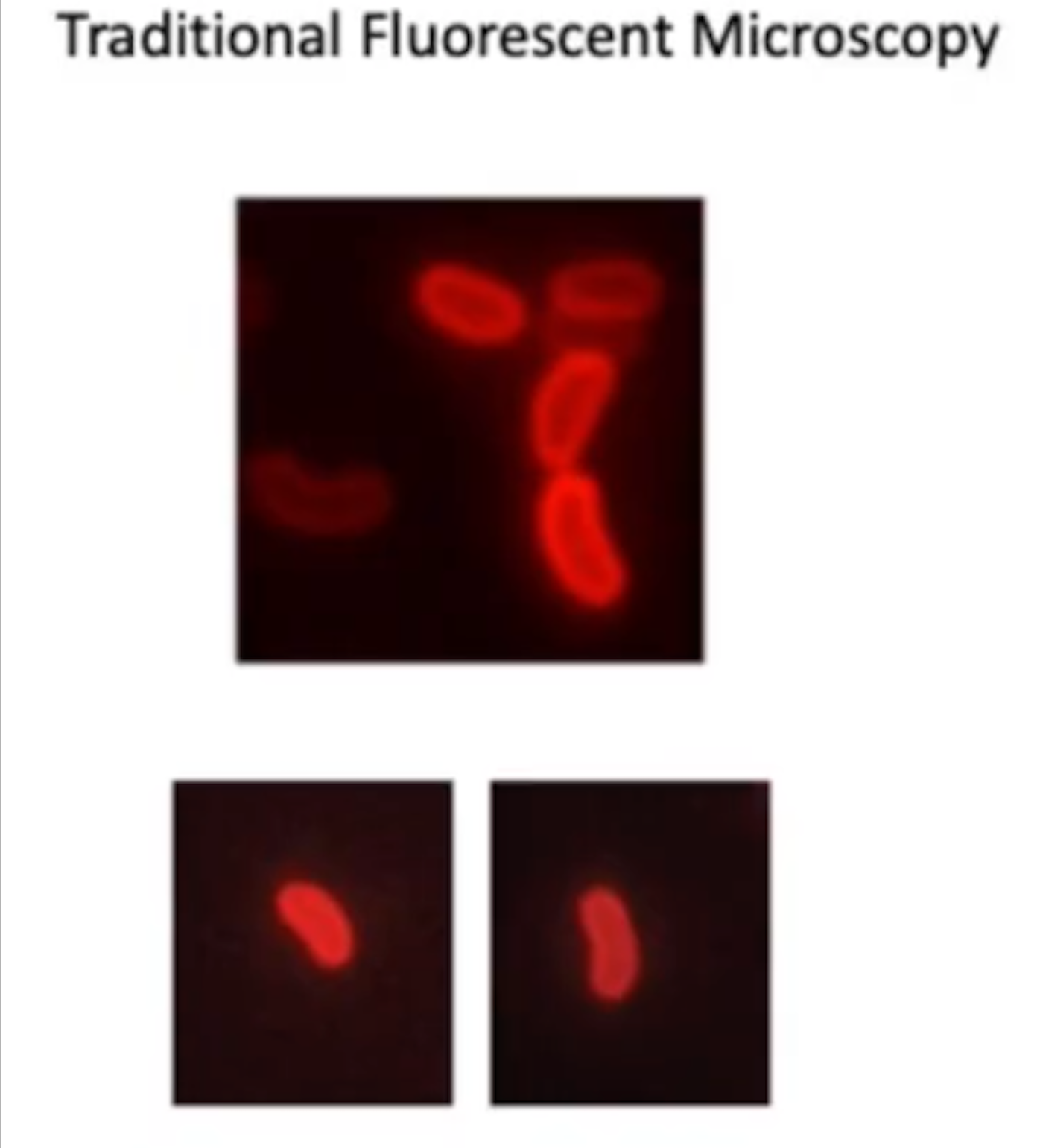 <p>Traditional Fluorescent Microscopy</p>