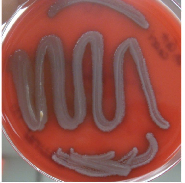 <p><span>blood agar- gamma hemolysis; no hemolysis</span></p>
