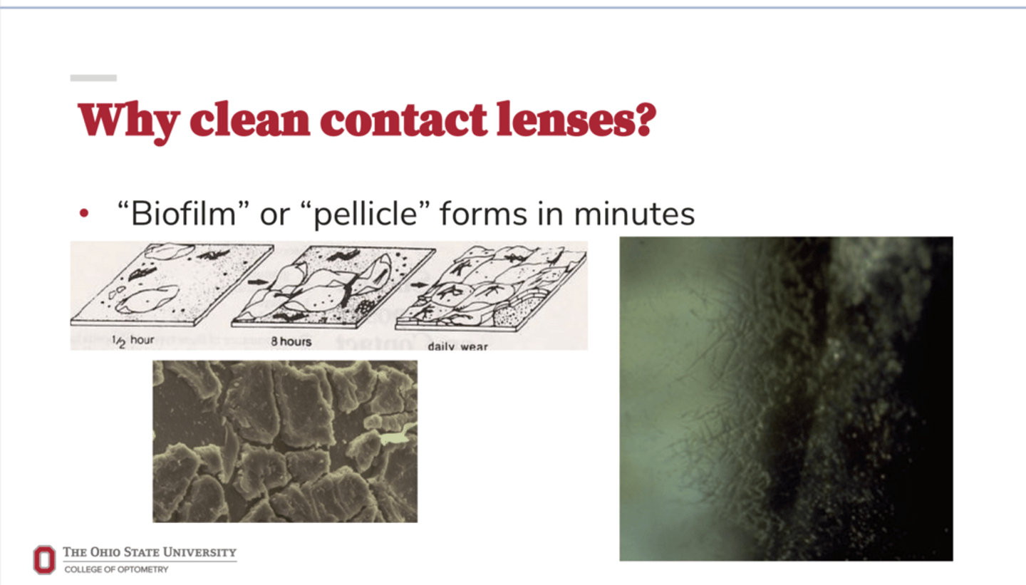 <p>Why is it important to wear contact lenses?</p>