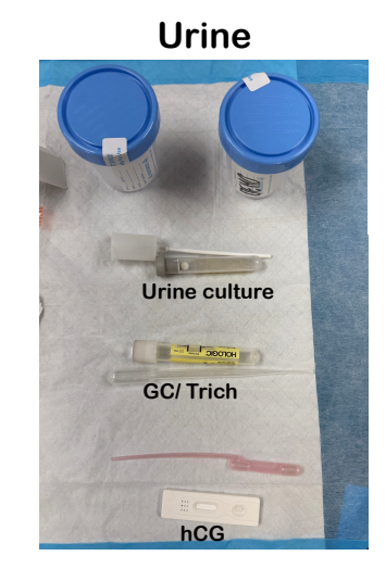 <p>Collecting urine:</p><p>General Collection (Clean Catch Mid-Stream)</p><p></p><p><strong>Male Anatomy</strong>: Wipe once, then perform a mid-stream catch.</p><p></p><p><strong>Female Anatomy</strong>: Wipe three times (right, left, middle) from front to back, then perform a mid-stream catch</p><p></p><p>Actual Procedure:</p><ul><li><p>Submerge a stick into urine.</p><p></p></li><li><p>Puncture the vacuum tube via needle inside the tube holder.</p><p></p></li><li><p>Label tube with name, date, time, and initials.</p><p></p></li><li><p>Place in a transport bag.</p></li></ul><p></p>
