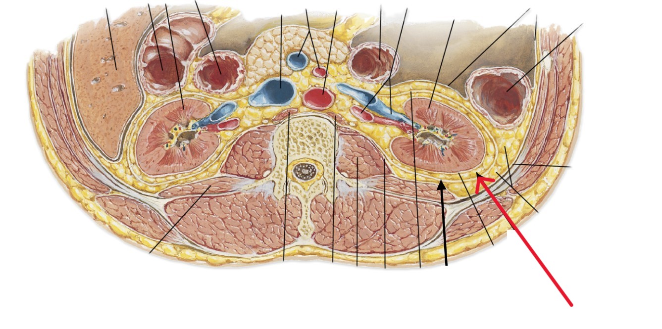 <p>Which part of the kidneys:</p><ul><li><p>Adipose tissue that surrounds kidney</p></li></ul><p></p>
