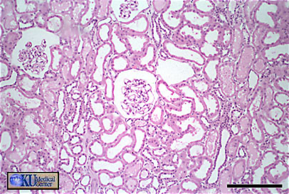 <p><span><span>Name the clear space seen surrounding the tufts of capillary loops.</span></span></p>