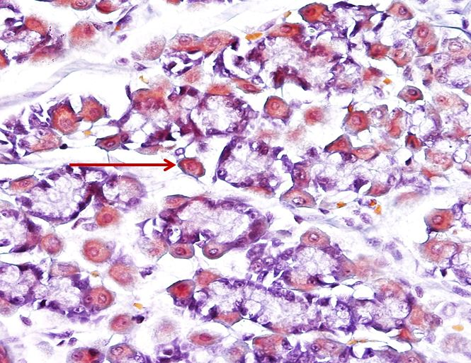 <p>Tế bào gì ?</p>