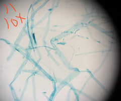 <p>• Some unicellular, some multicellular with cellular units called hyphae</p><p>• Cell wall comprised of cellulose</p><p>• Diploid dominant life cycle (produce large egg)</p><p>• Heterotrophic, very important in decomposing organic matter</p><p>• Saprolegnia</p>