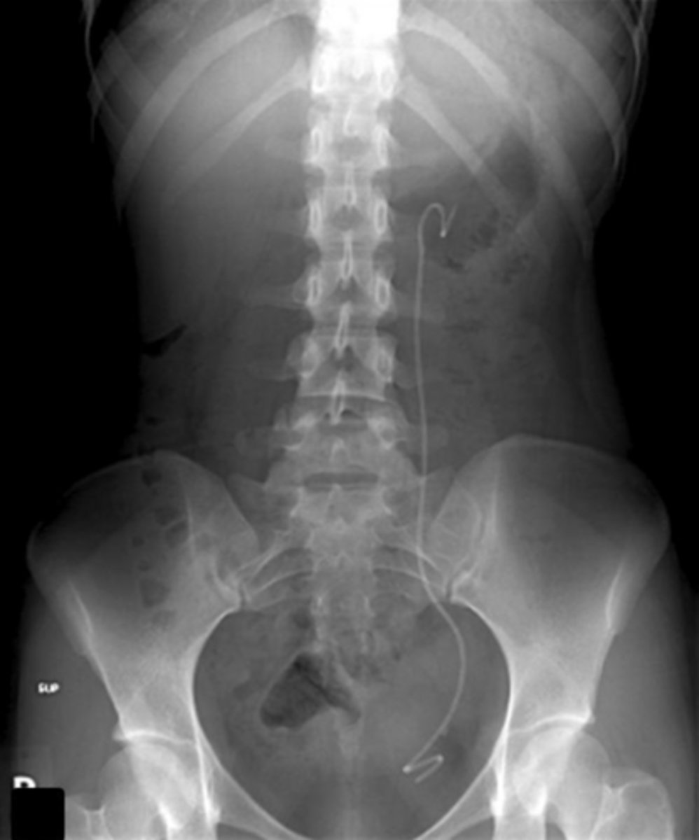 <p>connects between kidney and bladder</p>