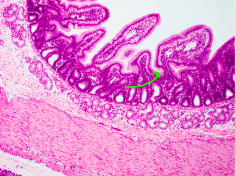 knowt flashcard image