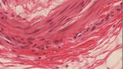 <p>ID the tissue type and where </p>