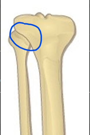 <p>What is this joint?</p>