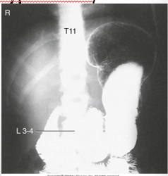 <p>what type of patient is this?</p>